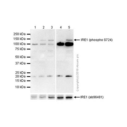 22768. RECOMBINANT ANTI-IRE1 (PHOSPHO S724) ANTIBODY (EPR5253) 100UL ABCAM