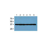 20582. ANTI- GAPDH ANTIBODY (GA1R) LOADING CONTROL 100UG - ABCAM