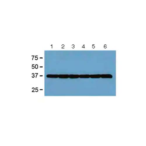 20582. ANTI- GAPDH ANTIBODY (GA1R) LOADING CONTROL 100UG - ABCAM