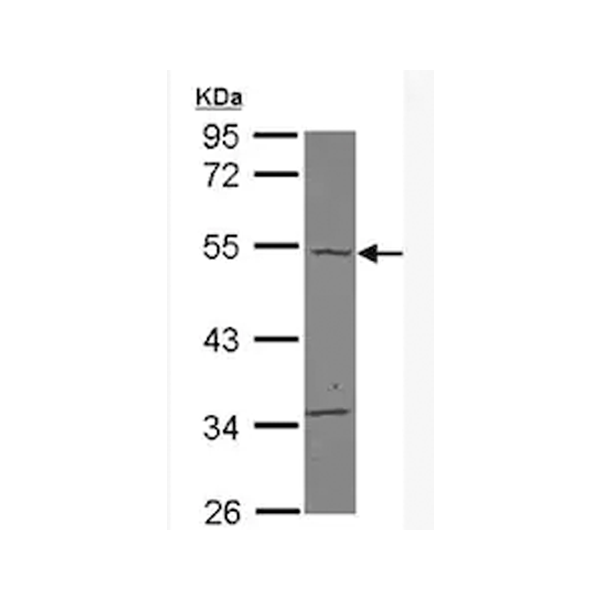 2949. ANTI-CARABIN ANTIBODY 50UL - ABCAM