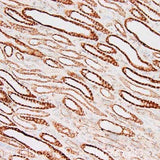 4664. ANTI-CPT1A ANTIBODY (8F6AE9) 100UG - ABCAM