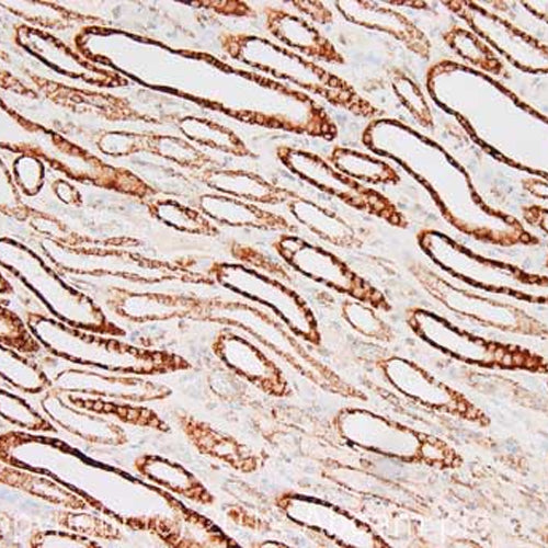 4664. ANTI-CPT1A ANTIBODY (8F6AE9) 100UG - ABCAM