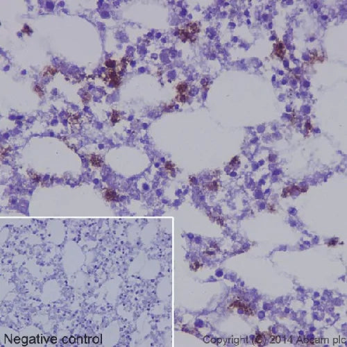 4651. RECOMBINANT ANTI-NEUTROPHIL ELASTASE ANTIBODY (EPR7479) 100UL - ABCAM