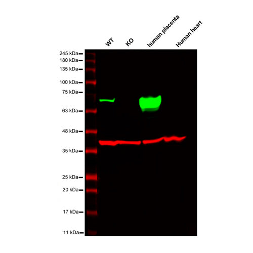 6884. ANTI-PLACENTAL ALKALINE PHOSPHATASE (PLAP) ANTIBODY (EPR6141) 100UL ABCAM