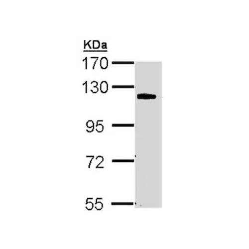 22770. ANTI-CARMA 3 ANTIBODY 100UL ABCAM