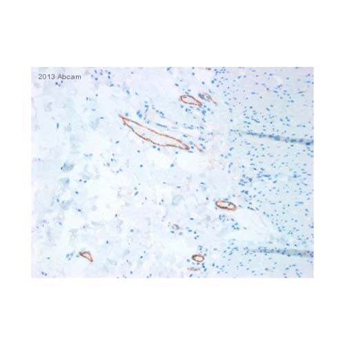 22771. ANTI-5HT1B RECEPTOR ANTIBODY 100UG ABCAM
