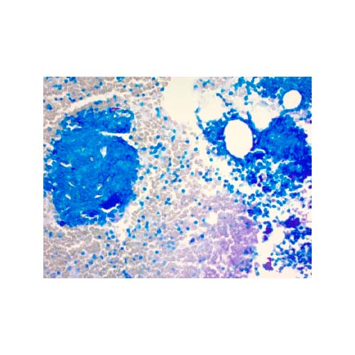 21425. GIEMSA STAIN KIT 100 TESTS - ABCAM