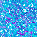 26406. PERIODIC ACID SCHIFF (PAS) STAIN KIT (MUCIN STAIN) 100 TESTS ABCAM