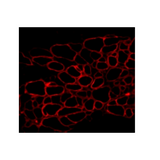 17784. ANTI-DYSTROPIN ANTIBODY 500UL - ABCAM