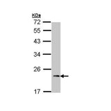 22777. ANTI-CARDIAC TROPONIN I ANTIBODY 100UL ABCAM