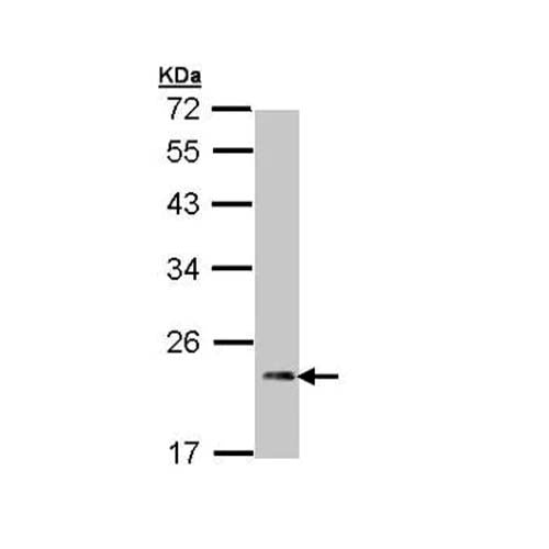 22777. ANTI-CARDIAC TROPONIN I ANTIBODY 100UL ABCAM