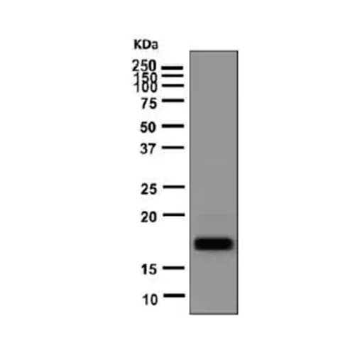 22778. RECOMBINANT ANTI-TSH BETA ANTIBODY (EPR8198) 100UL ABCAM