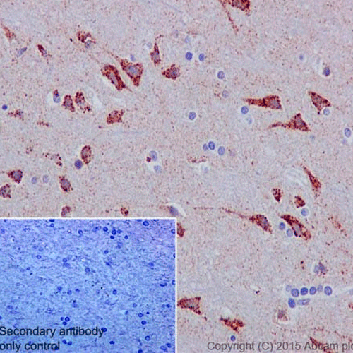 26423. RECOMBINANT ANTI-GLUTAMINASE ANTIBODY (EP7212) 100UL  ABCAM