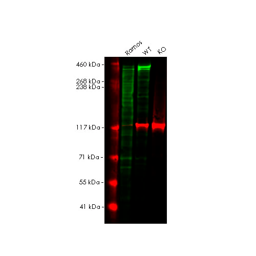 17791. RECOMBINANT ANTI-KI67 ANTIBODY (SP6) 100UL ABCAM