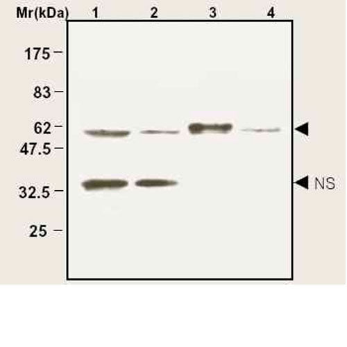 2929. ANTI-CATALASE ANTIBODY-PEROXISOME MARKER 100UL ABCAM