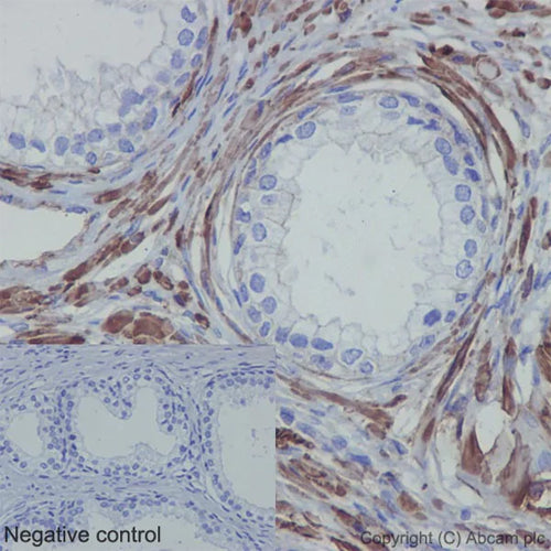 4661. RECOMBINANT ANTI-ACTIN ANTIBODY (EPR16769) 100UL - ABCAM