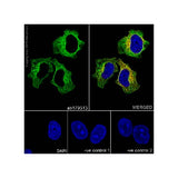 22790. RECOMBINANT ANTI-BETA TUBULIN ANTIBODY (EPR16774) 100UL ABCAM