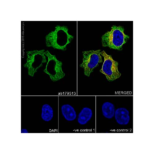 22790. RECOMBINANT ANTI-BETA TUBULIN ANTIBODY (EPR16774) 100UL ABCAM