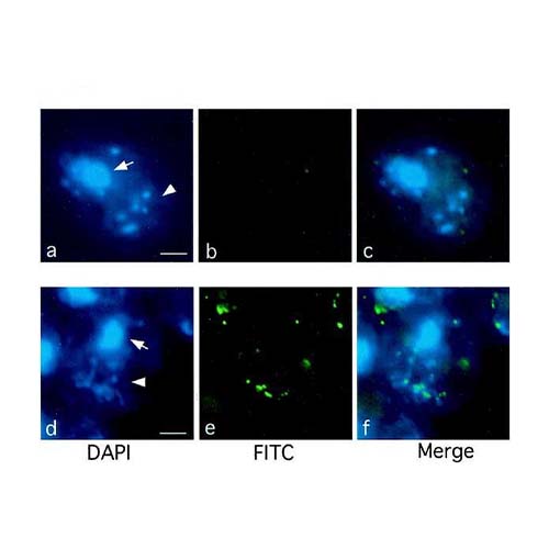 22791. FITC ANTI-5-METHYLCYTOSINE (5-MC) ANTIBODY (5MC-CD) 50UG ABCAM