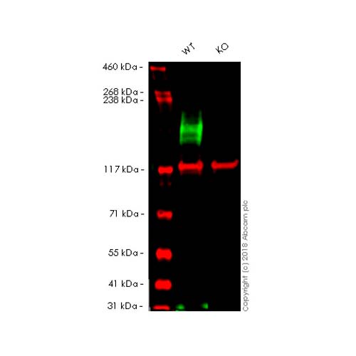 22792. RECOMBINANT ANTI-MRP1 ANTIBODY (EPR4658(2)) C-TERMINAL 100UL ABCAM