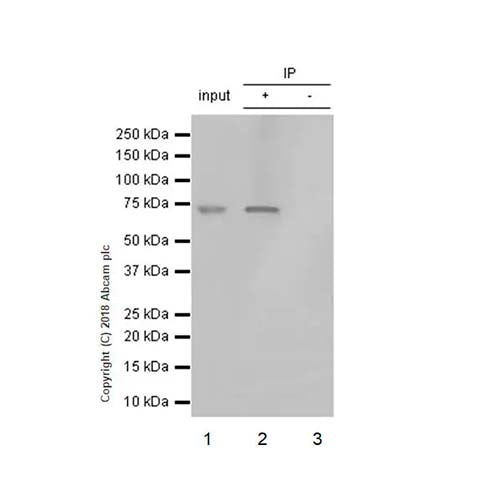 22793. RECOMBINANT ANTI-MMP2 ANTIBODY (EPR17003-25) 100UL ABCAM