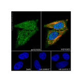 22794. RECOMBINANT ANTI-HSP70 ANTIBODY (EPR16892) 100UL ABCAM