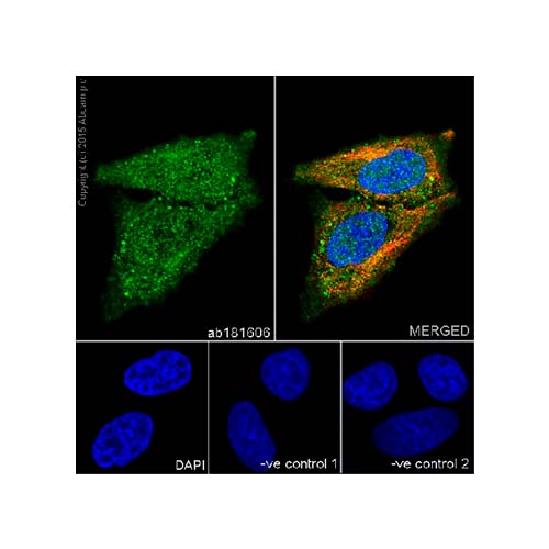 22794. RECOMBINANT ANTI-HSP70 ANTIBODY (EPR16892) 100UL ABCAM