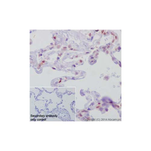 15699. RECOMBINANT ANTI-RB ANTIBODY (EPR17512) 100UL - ABCAM