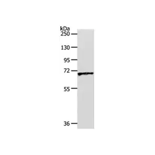 26476. ANTI-SLC22A3/OCT3 ANTIBODY 100UL ABCAM