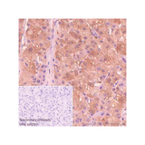 56833. RECOMBINANT ANTI-LIVER ARGINASE ANTIBODY (SP156) 1ML - ABCAM