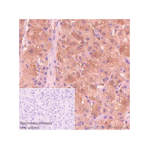 17797. RECOMBINANT ANTI-LIVER ARGINASE ANTIBODY (SP156) 1ML - ABCAM