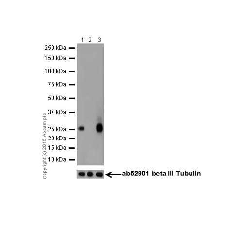 26489. RECOMBINANT ANTI-PHD3 ANTIBODY (EPR17869) 100UL ABCAM