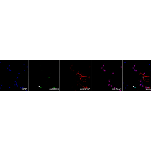 26441. RECOMBINANT ANTI-SOX9 ANTIBODY (EPR14335-78) 100UL ABCAM