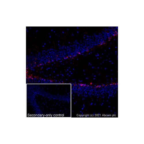 22798. ANTI-DOUBLECORTIN ANTIBODY 50UG ABCAM