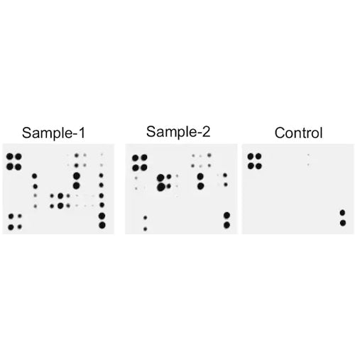 4687. HUMAN RTK PHOSPHORYLATION ANTIBODY ARRAY -MEMBRANE (71 TARGETS) 1X8 MEMBRANES - ABCAM