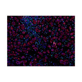 22805. RECOMBINANT ANTI-FOXP3 ANTIBODY (236A/E7) 100UG ABCAM