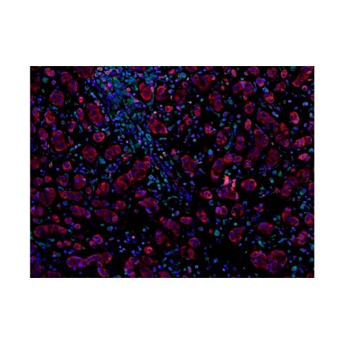 22805. RECOMBINANT ANTI-FOXP3 ANTIBODY (236A/E7) 100UG ABCAM