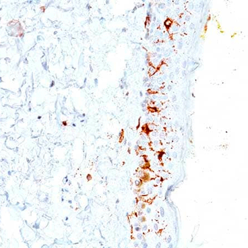 26495. ANTI-CD 1A ANTIBODY (C1A/711) 500UL ABCAM