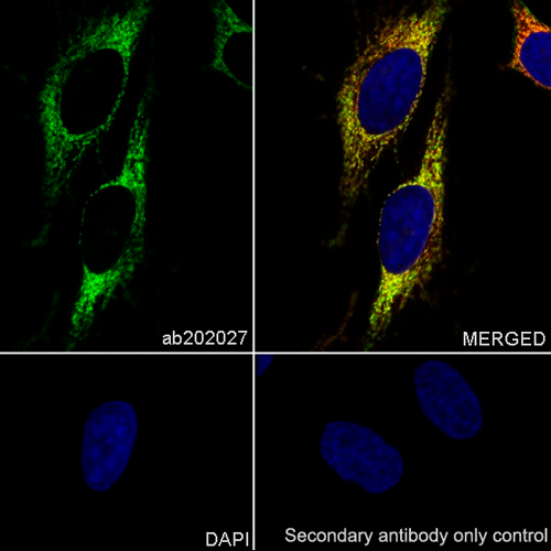 26472. RECOMBINANT ANTI-GLUTAMINASE C ANTIBODY (EPR19525) 100UL ABCAM