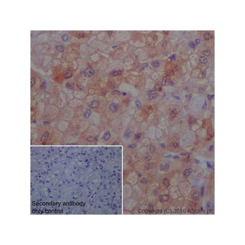 22806. RECOMBINANT ANTI-JAK1 (PHOSPHO Y1022 Y1023) ANTIBODY (EPR1899(2)) - BSA AND AZIDE FREE 100UG ABCAM