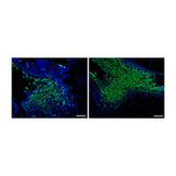 22807. ANTI-ASPERGILLUS ANTIBODY 100UL ABCAM