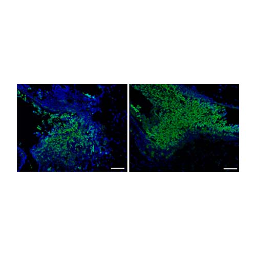 22807. ANTI-ASPERGILLUS ANTIBODY 100UL ABCAM