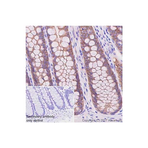 22812. RECOMBINANT ANTI-OCCLUDIN ANTIBODY (EPR20992) 100UL ABCAM