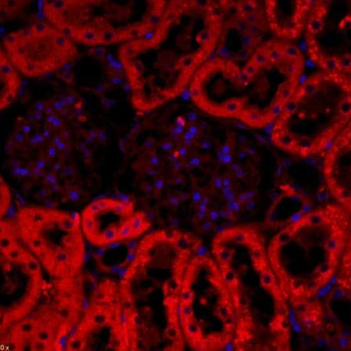 4620. ANTI-CRF ANTIBODY 100UL - ABCAM