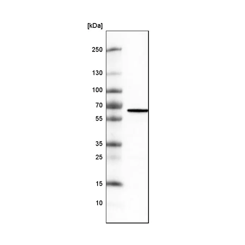 26478. ANTI-METTL14 ANTIBODY (CL4252) 100UL ABCAM