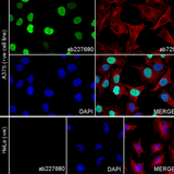 26452. RECOMBINANT ANTI-SOX10 ANTIBODY (SP267) 100UL ABCAM