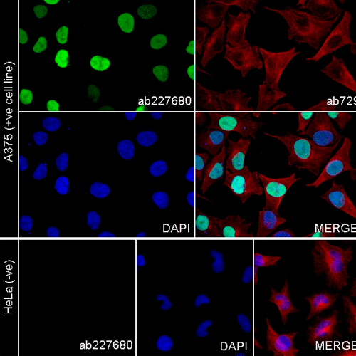 26452. RECOMBINANT ANTI-SOX10 ANTIBODY (SP267) 100UL ABCAM