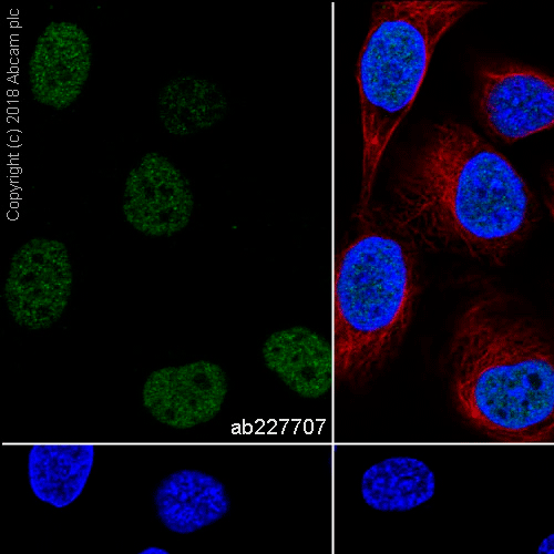 26416. RECOMBINANT ANTI-PAX8 ANTIBODY (SP348)-N-TERMINAL 1ML ABCAM