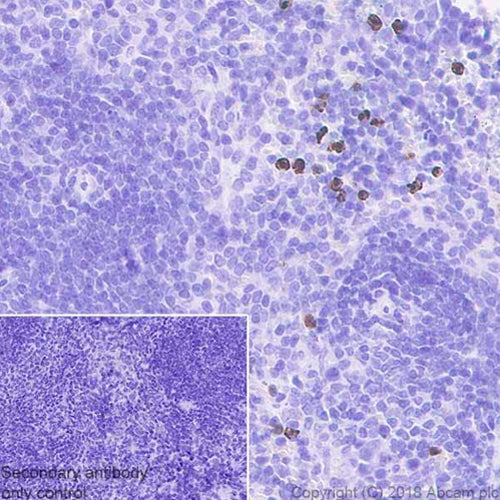 4630. RECOMBINANT ANTI-MMP9 ANTIBODY (EPR22140-154) 100UL - ABCAM