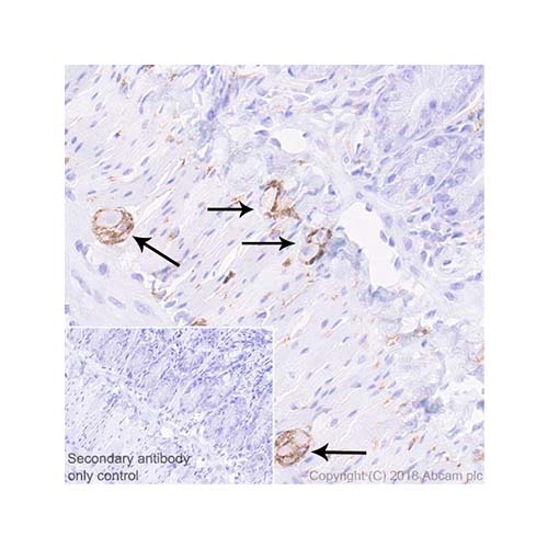56817. RECOMBINANT ANTI-NCAM1 ANTIBODY (EPR21827) - BSA AND AZIDE FREE 100UG ABCAM